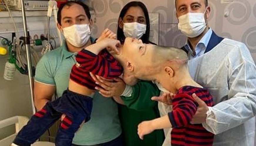 Surgeons Use Virtual Reality To Separate Conjoined Twins